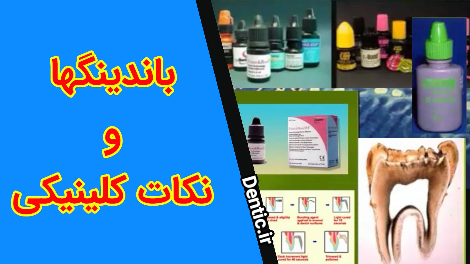 باندینگها و نکات کلینیکی