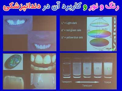 رنگ و نور و کاربرد آن در دندانپزشکی