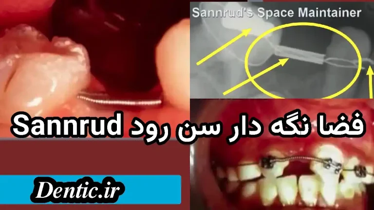 فضا نگه دار سن رود Sannrud