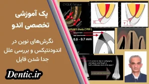 پک آموزشی تخصصی اندو: نگرش‌های نوین در اندودنتیکس و بررسی علل جدا شدن فایل