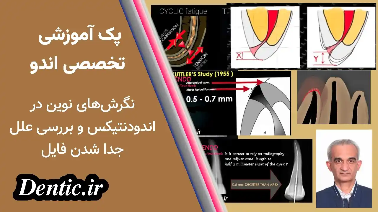 پک اندو تکمیلی