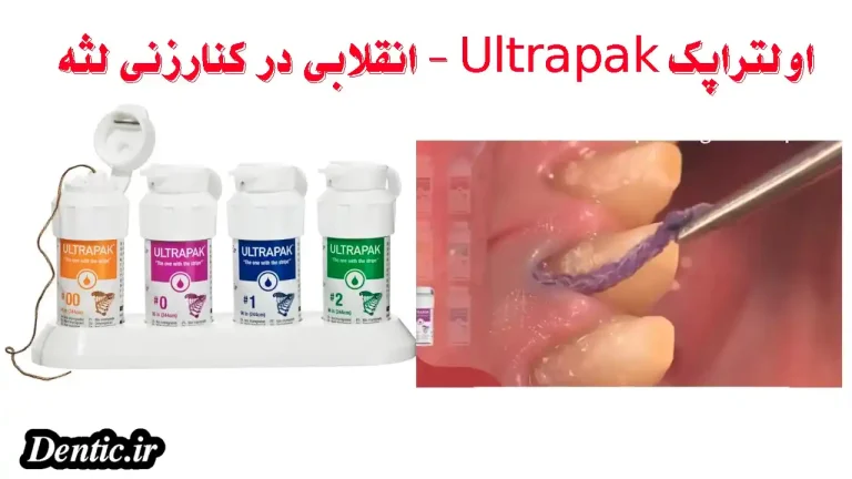اولتراپک Ultrapak - انقلابی در کنارزنی لثه
