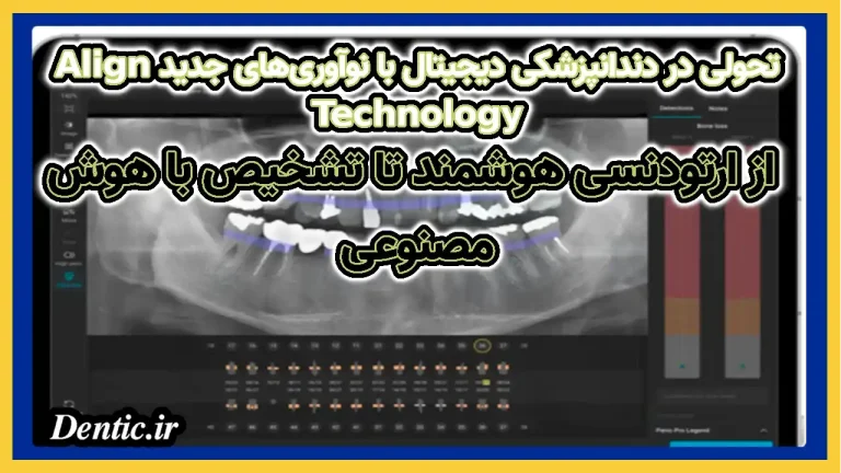 تحولی در دندانپزشکی دیجیتال با نوآوری‌های جدید Align Technology: از ارتودنسی هوشمند تا تشخیص با هوش مصنوعی