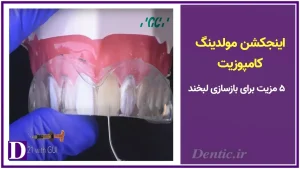 اینجکشن مولدینگ کامپوزیت